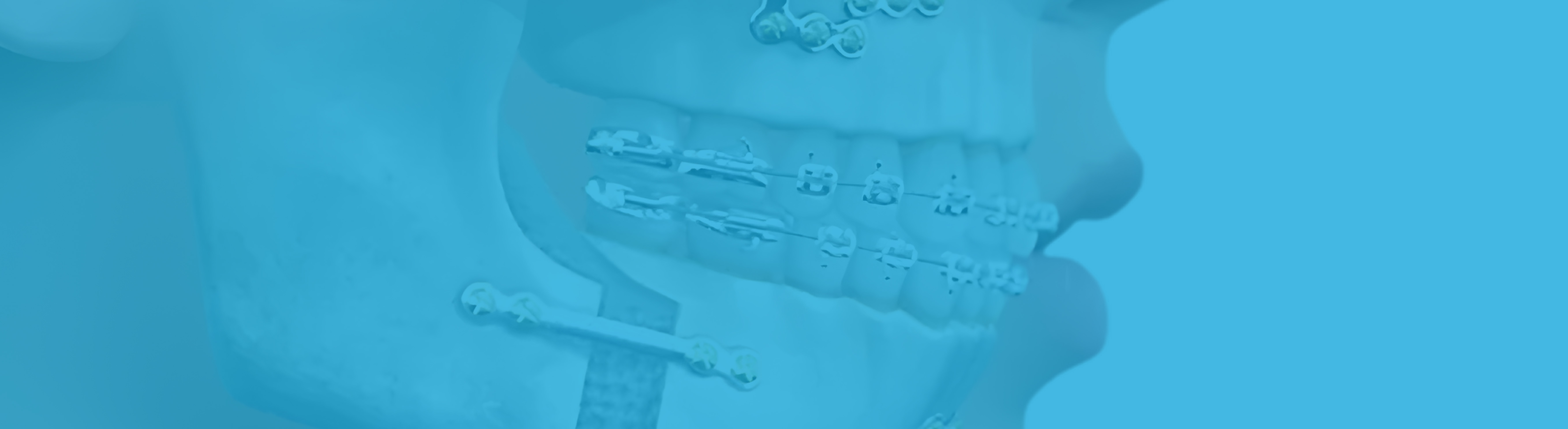 Banner de Cirugía Maxilofacial