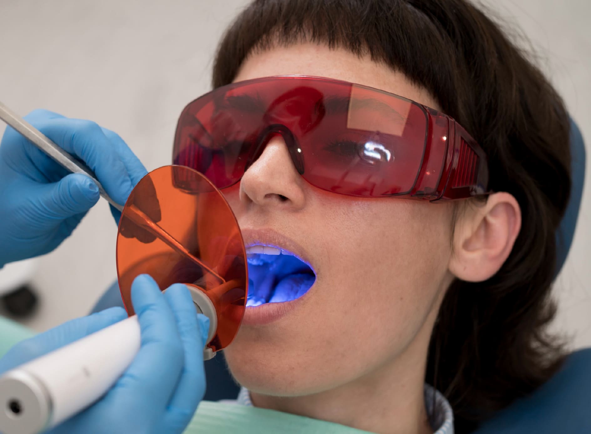 Blanqueamiento Dental